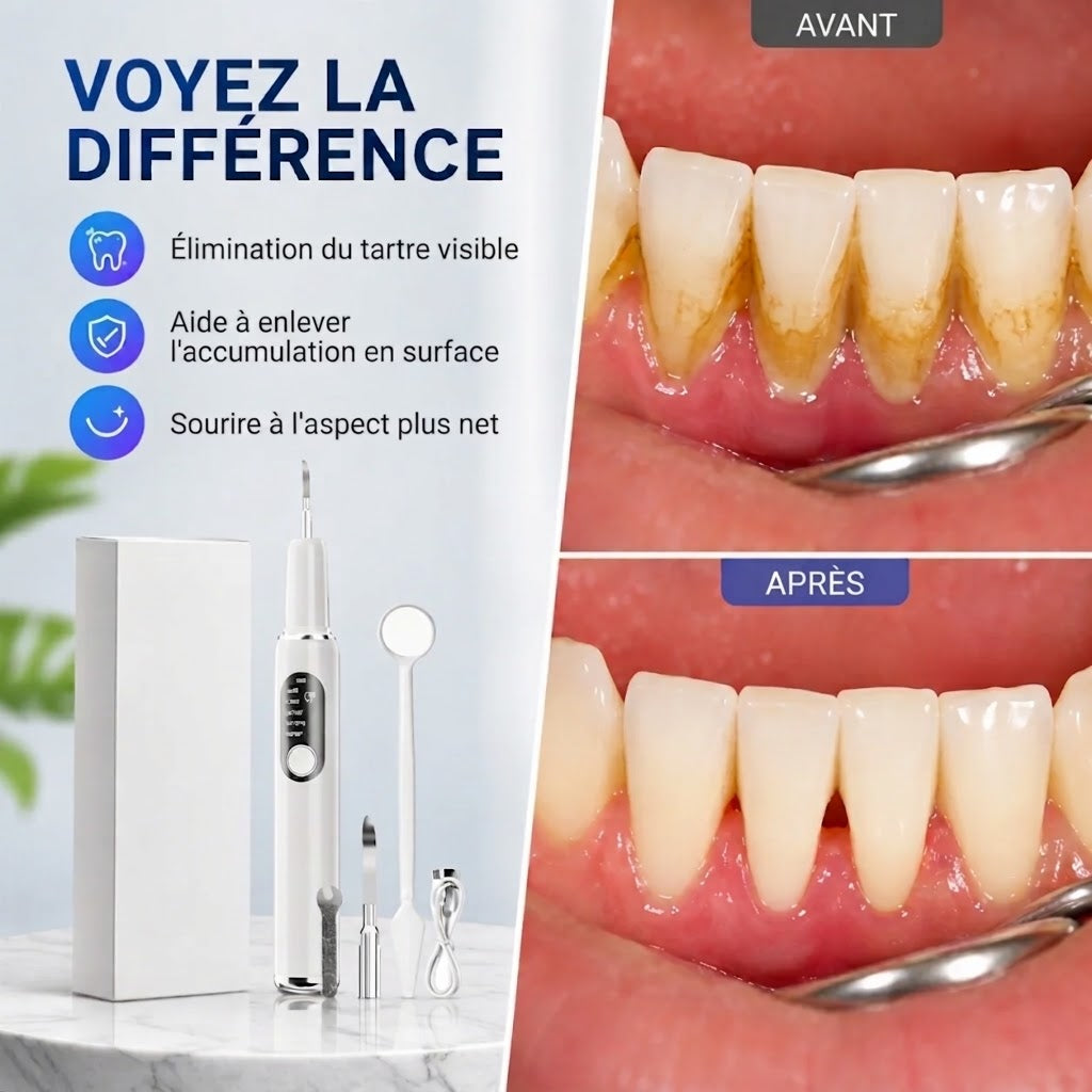 Set de nettoyeur de dents à ultrasons portable et détartreur dentaire