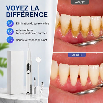 Set de nettoyeur de dents à ultrasons portable et détartreur dentaire